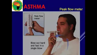 ASTHMA Part 2