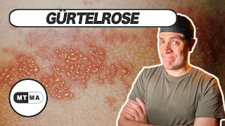 Gürtelrose - Herpes Zoster, was das ist und was man dagegen machen kann