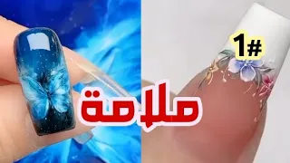 1# عيب خلقي (فتحة في سقف الحلق...!!) _قصص رون