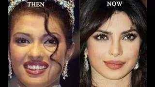 11 Top Celebrities Plastic Surgery Before and After Unseen Shocking Photos