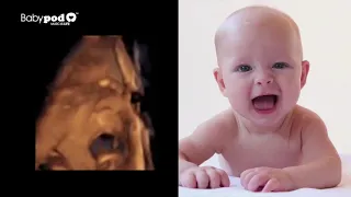 Babypod ¿Cómo reaccionan un feto vs un bebé ante la música?