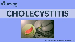 Breaking down CHOLECYSTITIS, and understanding what this is (Nursing School Lesson)