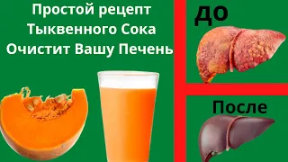 Всего 1 Стакан Тыквенного Сока Утром Очистит Печень/Рецепт Самого Простого  Сока#тыква#тыкварецепты