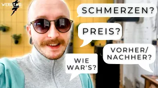 Ich hab mir die AUGEN LASERN lassen... 😎 | 26.+27.10.21 | #WERKTAG. mit Jonas Winkler