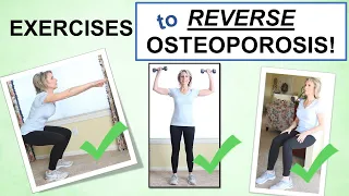Reversing Osteoporosis Naturally Through Exercise – Best Exercises to Build Bone!