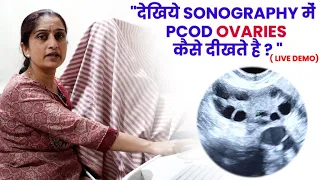 देखिये Sonography में  PCOD Ovaries कैसे दीखते है ? -Dr Asha Gavade