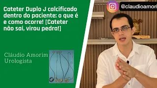 Cateter Duplo J calcificado dentro do paciente: o que é e como ocorre!