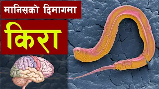 कसरी पुग्यो दिमागमा किरा | Inside human brain | Bishwo Ghatana