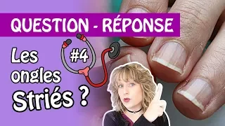 #4 Pourquoi j'ai les ongles striés ? Comment les lisser ?