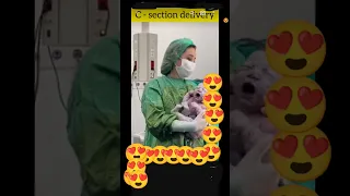 c- section delivery#shortvideoviral#baby girl