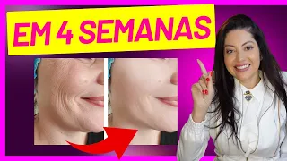 Como Melhorar RUGAS, MANCHAS, ACNE, MELASMA e POROS DILATADOS com RETINOL | Dra. Greice Moraes