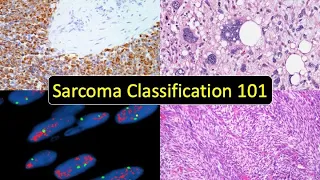 Sarcoma Classification 101: Soft Tissue Tumor Naming Made Simple (for Beginners & Non-Pathologists)