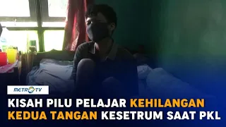 Kisah Pilu Pelajar SMK Kehilangan Kedua Tangan saat PKL