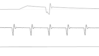 COMMODORE C64 SID 2020 - STAY AWAY ! :D (alpha version) - CHRIS-DO / Oscilloscope View