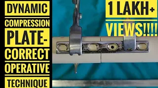 Dynamic Compression Plate (DCP)- Correct Operative Technique