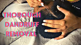 Scalp Check | Scratching & Nitpicking | Thorough, Satisfying, & Relaxing