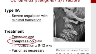 MILLER'S 2016 Orthopaedics: Spine