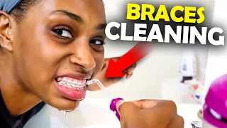 Morning Routine with Braces... Orthodontist Reacts