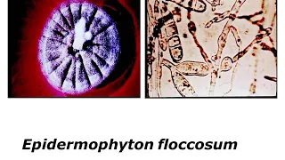 Lucture 7 - Superficial Mycosis