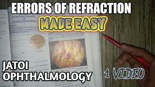 Errors of refraction || Eye || ophthalmology lectures