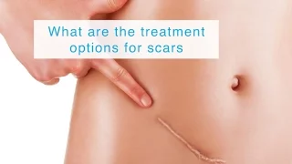 What are the treatment options for scars?