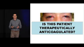 The Anticoagulated Patient in the ED | The Advanced EM Boot Camp