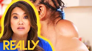 Dr Lee Removes Enormous 10-Year-Old Neck Cyst From Patient Who's In Constant Pain | Dr Pimple Popper