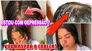 CALVICE FEMININA| ESTOU COM DEPRESSÃO ? | VOU RASPAR A CABEÇA? | OQUE EU TENHO ?