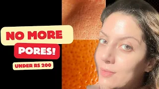 Treat open pores & texture in 2 weeks under Rs 200 | Nipun Kapur