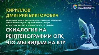 Скиалогия на рентгенографии ОГК, что мы видим на КТ? - Кириллов Дмитрий Викторович