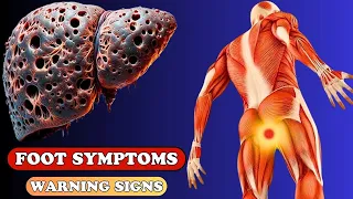 Warning Signs: 9 Unexpected Foot Symptoms of Liver Damage | Health care