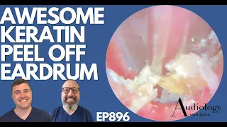 AWESOME KERATIN PEEL OFF EARDRUM - EP896