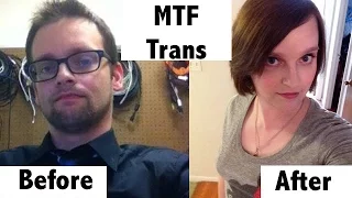 One Year On Hormones! | MtF Transition Timeline (MtF Transgender )