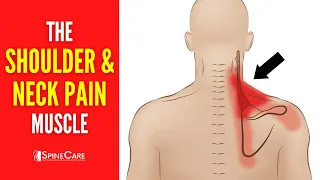 The Neck and Shoulder Pain Muscle (How to Release It for INSTANT RELIEF)