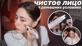 УЛЬТРАЗВУКОВАЯ ЧИСТКА ЛИЦА В ДОМАШНИХ УСЛОВИЯХ