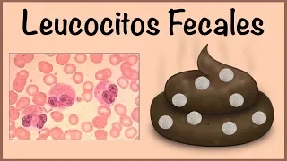 Leucocitos Fecales