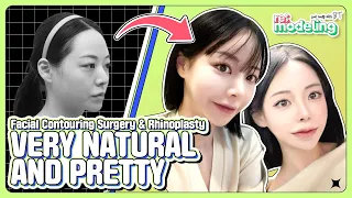 Facial Contouring Surgery Korea Before and After, Recovery, Dr Lee HoBin, Plastic Surgery Specialist