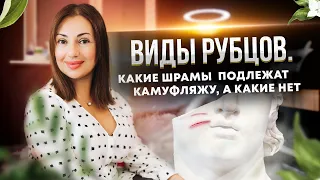 Виды рубцов. Какие шрамы подлежат камуфляжу, а какие нет.