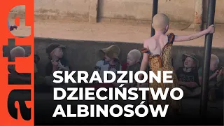 Tanzania: albinosi mordowani dla "amuletów" z ich ciała | ARTE.tv Dokumenty