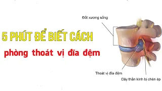 5 phút để biết cách phòng thoát vị đĩa đệm