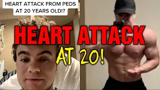 Heart Attack At 20 From Steroids