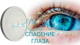 Активные Воспалительные процессы, как их лечить? Спасение глаза Катушками Мишина.