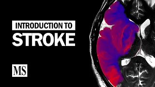Introduction To Stroke