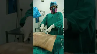 6 Pack Surgery in 1 Minute | 6 Pack Abs immediate Result