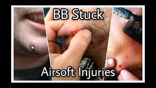 Airsoft Injuries : Awesome! BB Stuck in Face | Airsoft Worst