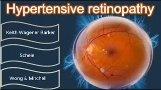 Hypertensive retinopathy simplified