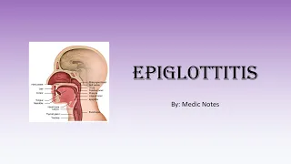 Epiglottitis - causes, signs and symptoms, investigation, management