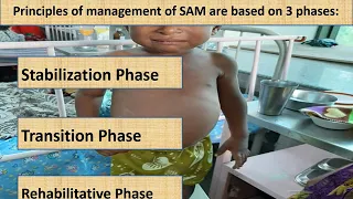 Severe Acute Malnutrition (Part 1/4) | Appetite test | Pediatrics