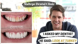 David's Veneer Experience in Istanbul, Turkey | Maltepe Dental Clinic