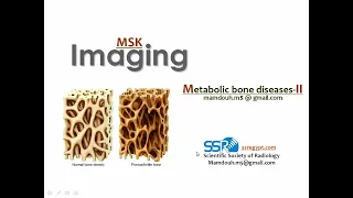 Imaging of Metabolic bone diseases (II) (DRE) Prof. Mamdouh Mahfouz